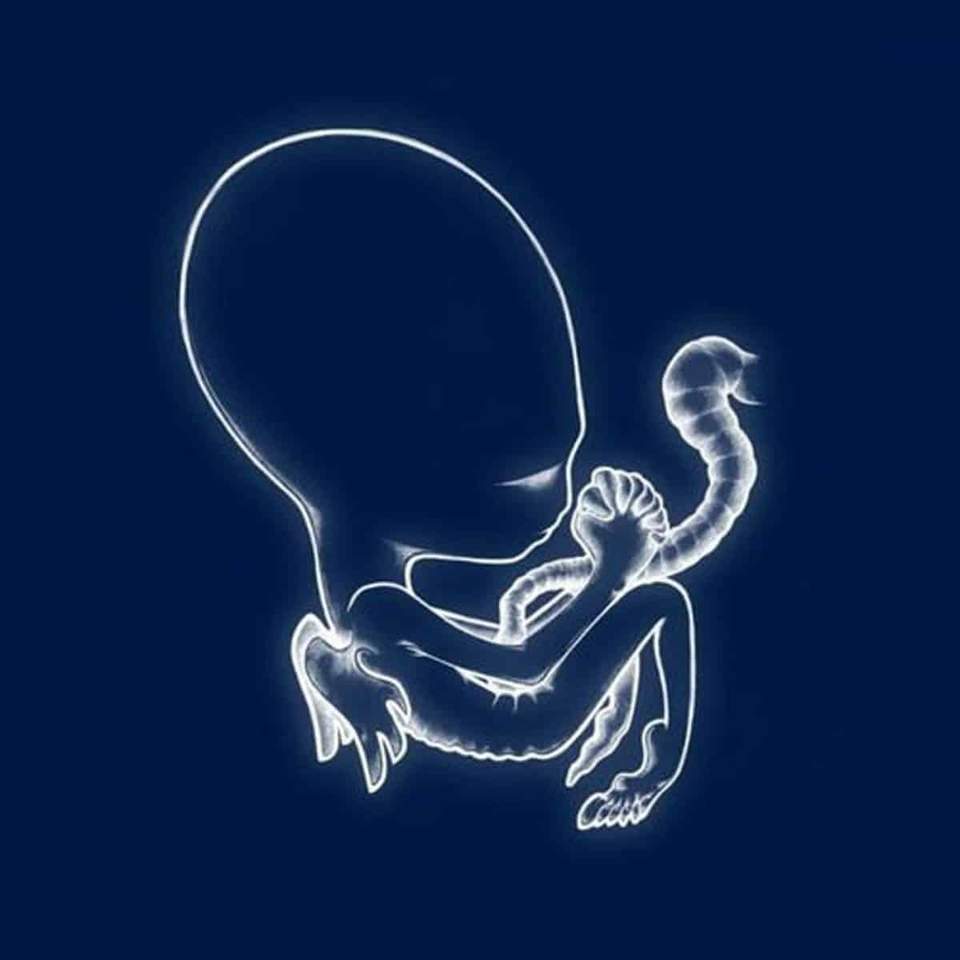 Sigur Ros - Agaetis byrjun